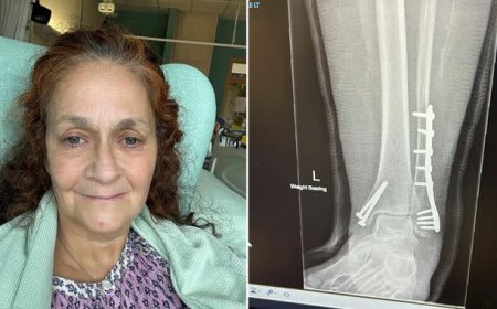 US motorist departs the UK following a collision that renders a British nurse unable to walk