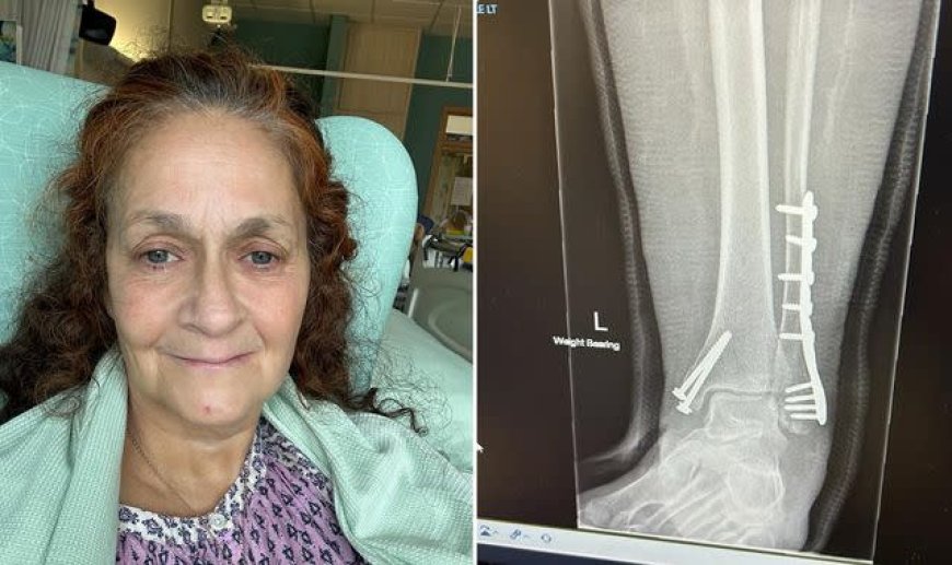 US motorist departs the UK following a collision that renders a British nurse unable to walk