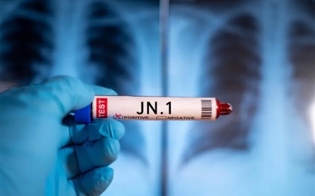 Four COVID-19 cases have been reported from Pakistan.